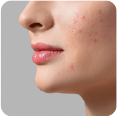 dermatologist