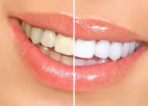 cosmetic-dentist