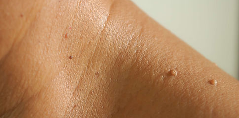 dermatologist