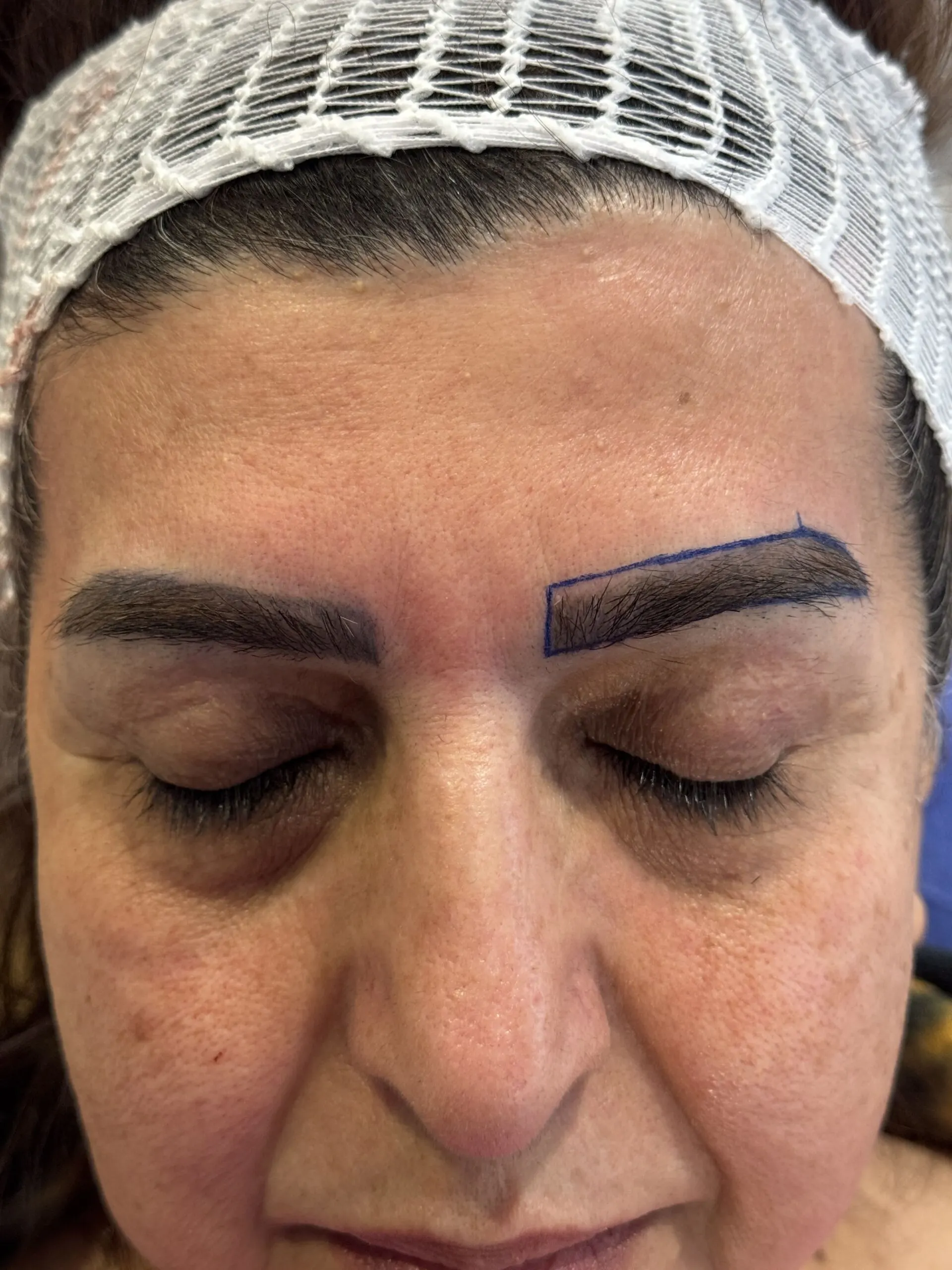 dermatologist