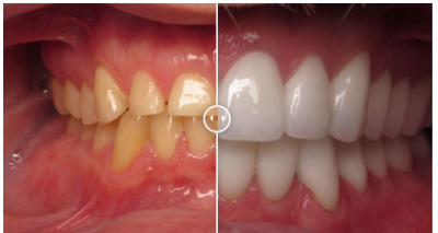 prosthodontist
